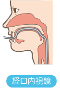 経口胃カメラ